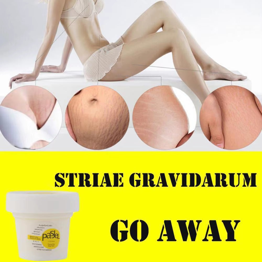 50Ml Stretch Mark Repair Cream Powerful Precious Body Scar Postpartum Stretch Marks Obesity Skin Care Remover W1T2